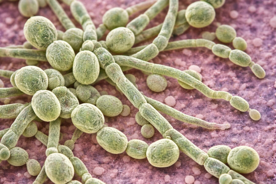 Candida Mantarı Nedir? Belirtileri, Türleri ve Vücutta Yarattığı Etkiler